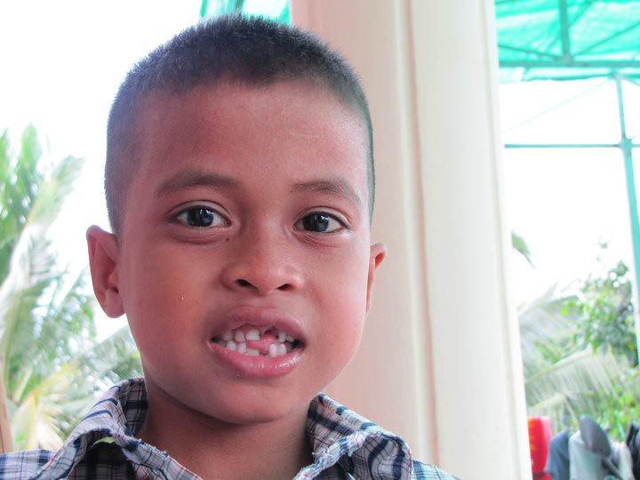 Close-up of young boy with missing teeth smiling